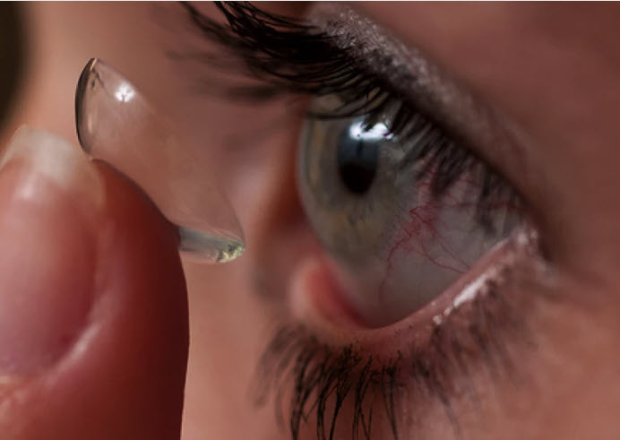 A patient inserts a medicated contact lens (Photo: Jeff Etheridge/Auburn University)