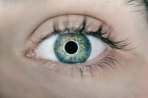 Human eye with a contact lens in that delivers medications at a control rate.