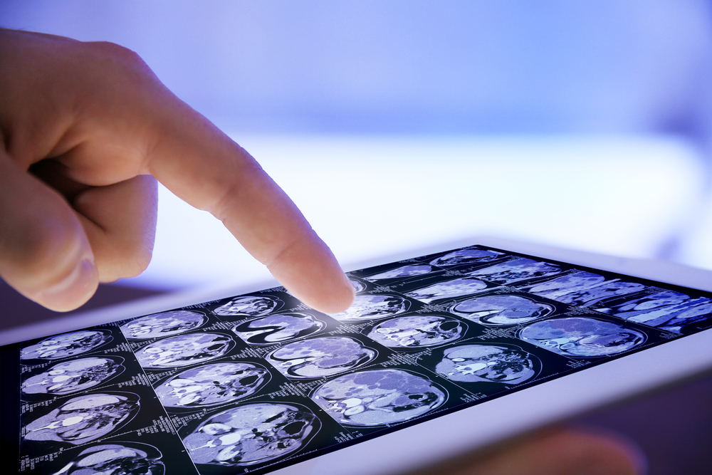 Healthcare professional using artificial intelligence to evaluate medical images to find patterns and suggest a diagnosis. Doctor hand touching modern digital tablet, close up.